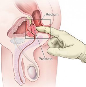 stimulation annale prostate
